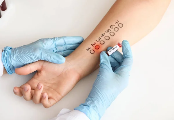 Young Woman Undergoing Procedure Allergen Skin Tests Clinic — Stock Photo, Image