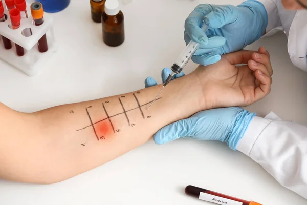 Young Woman Undergoing Procedure Allergen Skin Tests Clinic — Stock Photo, Image