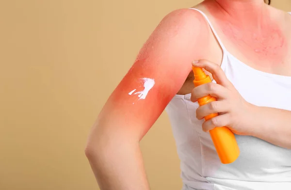 赤い日焼け肌の女性は色の背景にクリームを適用します — ストック写真
