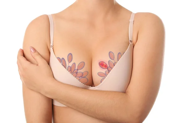 Collage Of Young Woman In Bra With Different Sizes Of Breast On White  Background. Plastic Surgery Concept Stock Photo, Picture and Royalty Free  Image. Image 162469848.