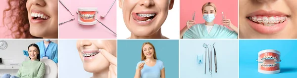 Sada Žen Zubními Rovnátky Zubním Keřem Zubním Lékařem Nářadím — Stock fotografie