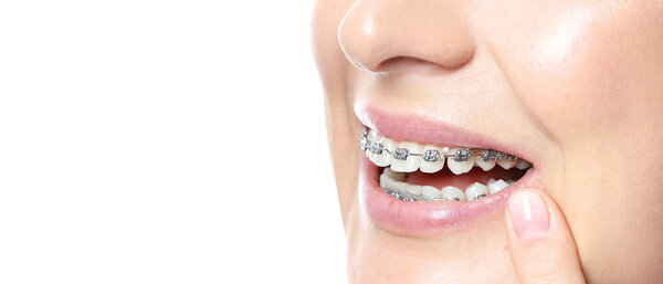 Woman with dental braces on white background with space for text, closeup