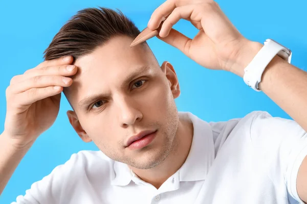 Young Man Hair Loss Problem Blue Background Closeup — Stock Photo, Image