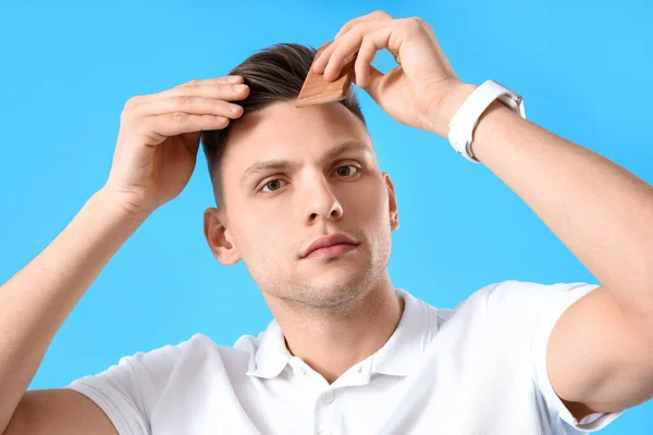Jeune Homme Avec Problème Perte Cheveux Sur Fond Bleu Gros — Photo