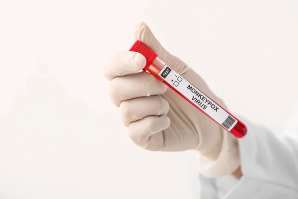 Ärztin Mit Blutprobe Auf Hellem Hintergrund Nahaufnahme Pockenvirus Konzept — Stockfoto
