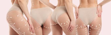 Hafif arkaplanda liposuction yaptıktan sonra güzel genç bayanla kolaj