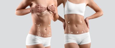 Collage with beautiful young women after liposuction on light background clipart