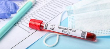 Üzerinde maymun çiçeği virüsü ve tıbbi maske örneği olan test tüpü, yakın plan.