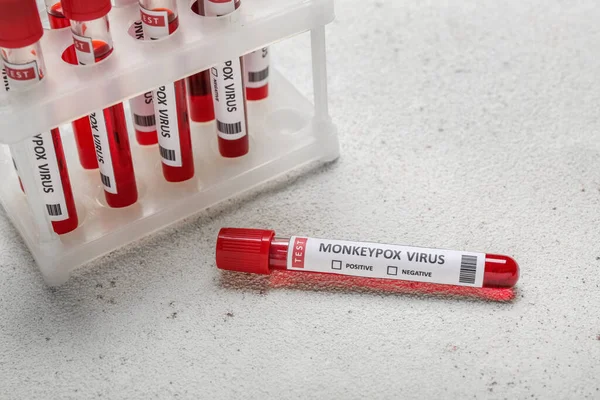 Arka Planda Kan Örnekleri Var Maymun Çiçeği Virüsü Konsepti — Stok fotoğraf