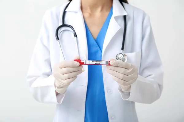 軽い背景で血液サンプルを持つ女性医師 天然痘ウイルスの概念 — ストック写真