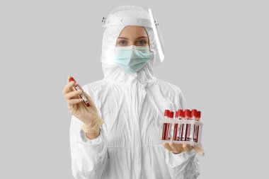 Scientist with samples of monkeypox virus on light background