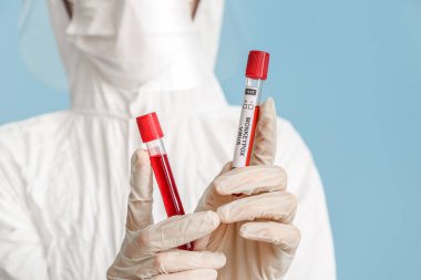 Scientist with samples of monkeypox virus on blue background, closeup