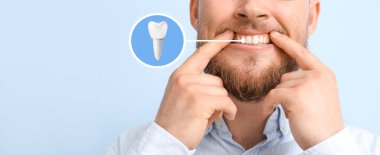 Man with implanted teeth on light blue background
