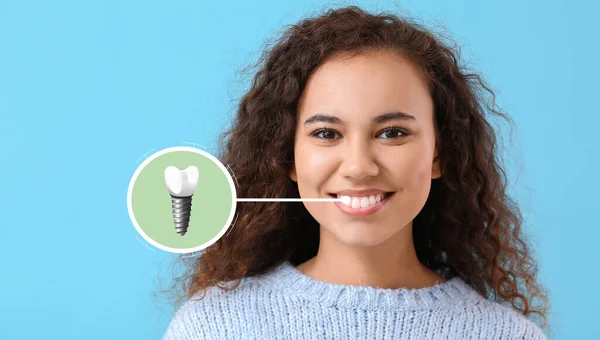 Young African American Woman Implanted Teeth Light Blue Background — Stok fotoğraf