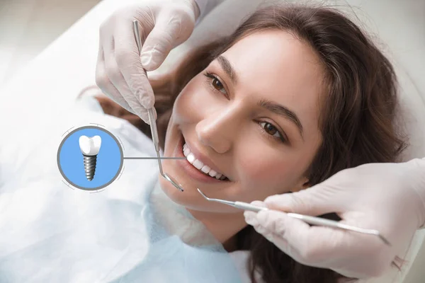 Young Woman Implanted Teeth Visiting Dentist Clinic — Stockfoto