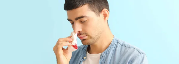 Young Man Having Nosebleed Light Blue Background — Foto de Stock