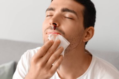 Young man wiping nosebleed with tissue at home, closeup