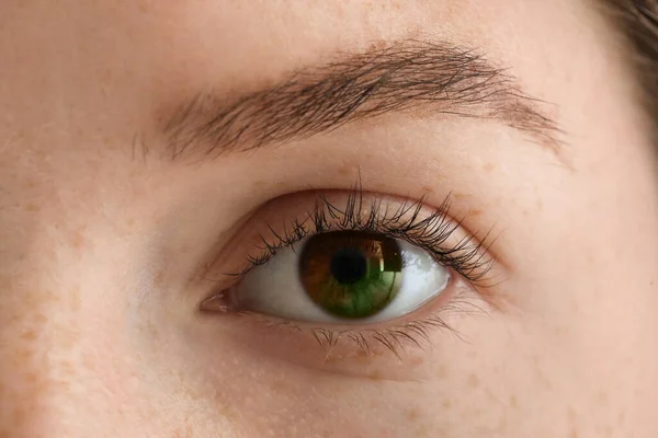Young Woman Heterochromia Eye Closeup — Stock Photo, Image