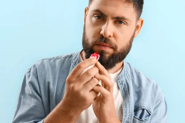 Young Bearded Man Nosebleed Tissue Blue Background Closeup — Stock Photo, Image