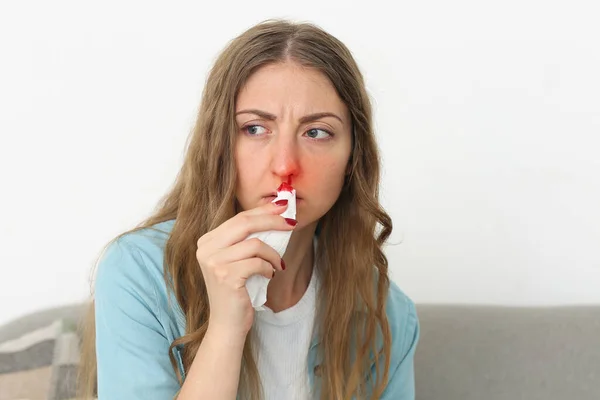 Mujer Joven Limpiando Hemorragia Nasal Con Tejido Casa — Foto de Stock