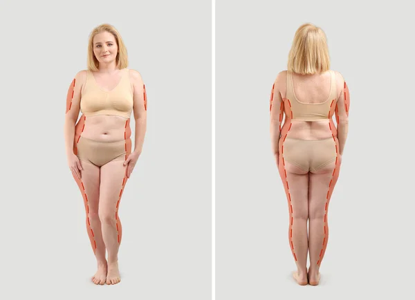 グレーの背景 前面と背面のビューに太りすぎの女性 整形手術の概念 — ストック写真
