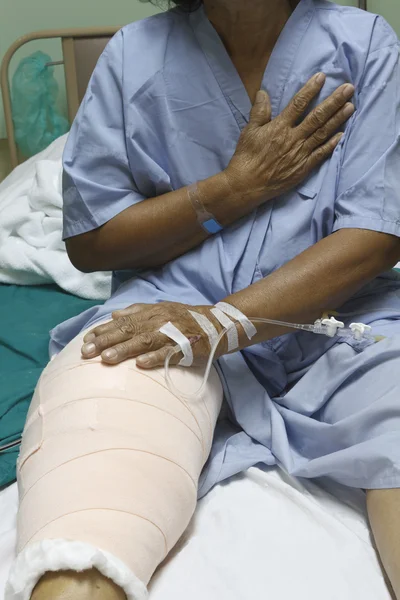 Knee replacement incision — Stock Photo, Image