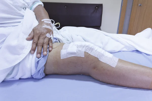 Knee replacement incision — Stock Photo, Image