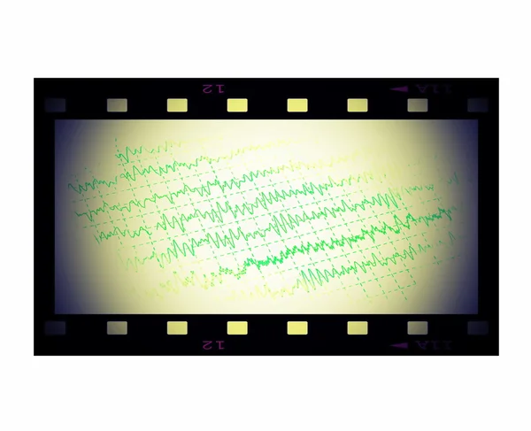 Graph brain wave EEG and film strip frame isolated on white — Stock Photo, Image