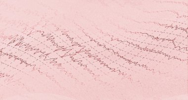 beyin dalga electroencephalogram epilepsi için eeg
