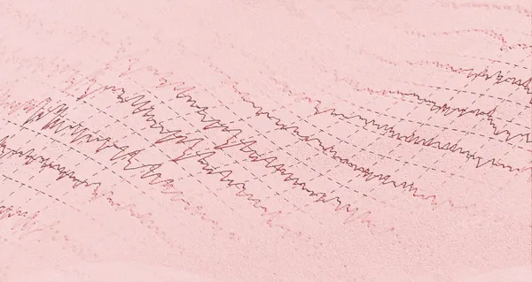 beyin dalga electroencephalogram epilepsi için eeg