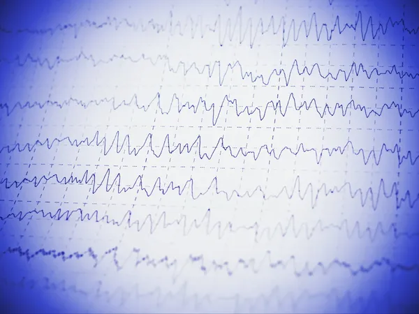 Grafik merah gelombang otak EEG — Stok Foto