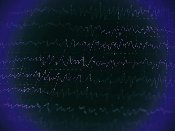 Red graph brain wave EEG — Stock Photo, Image