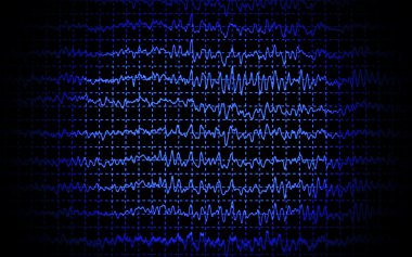 beyin dalga eeg siyah arka plan üzerine izole.
