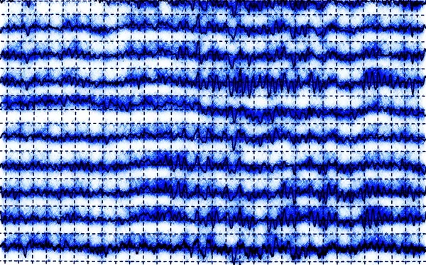 Gráfico conceitual onda cerebral EEG — Fotografia de Stock