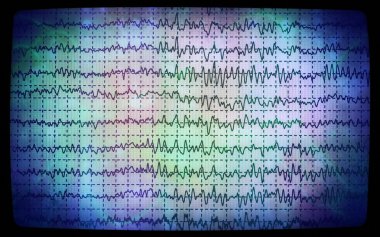 kavram grafik beyin dalga eeg