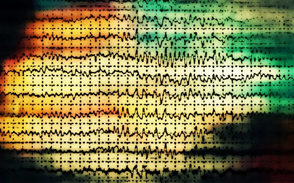 Kavram grafik beyin dalga eeg — Stok fotoğraf