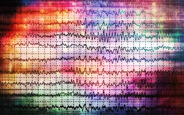 Koncepció grafikon agyi hullámok Eeg — Stock Fotó