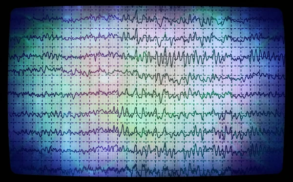 Concept graph brain wave EEG — Fotografie, imagine de stoc