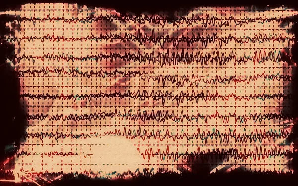 Концептуальний граф хвиля мозку EEG — стокове фото