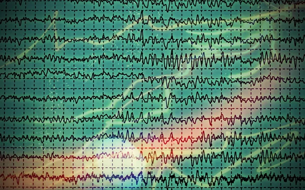 Gráfico conceitual onda cerebral EEG — Fotografia de Stock