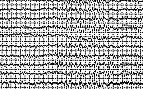 Padrão gráfico geométrico sem costura abstrato, Concept graph brain wave EEG — Fotografia de Stock