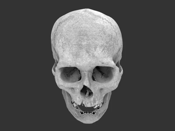 Human Skull Missing Teeth Top View — Stock Photo, Image