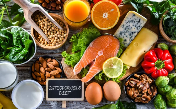 Productos Alimenticios Recomendados Para Osteoporosis Huesos Sanos — Foto de Stock