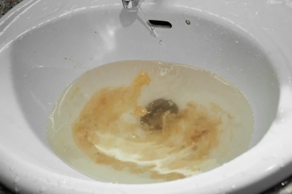 lavabo içinde kusma