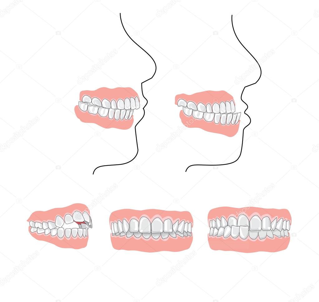 Jaw vector