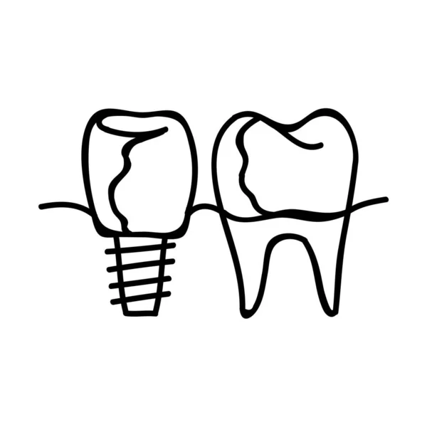 Tand Kunstgebit Icoon Handgetekende Vectorillustratie Aanpasbare Lijnslag — Stockvector