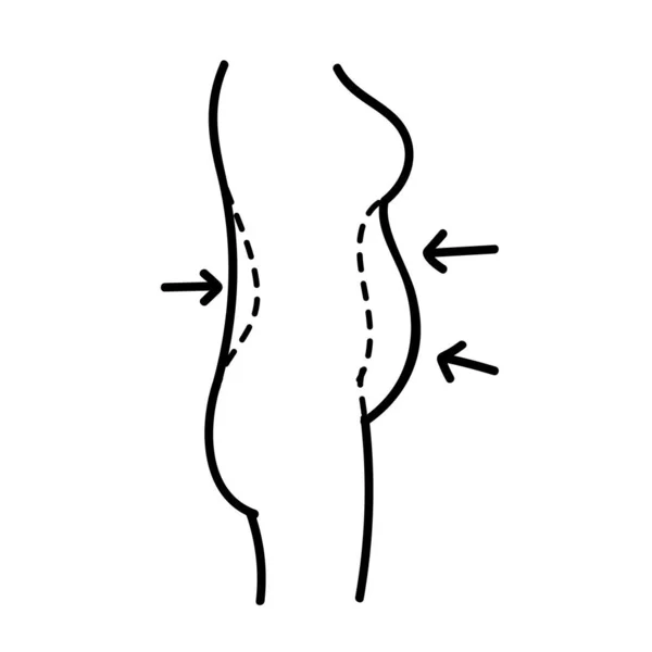 女性の美しさはプラスチック外科に直面する 腹部脂肪脂肪吸引 体の輪郭 手描きベクトルイラスト 編集可能なラインストローク — ストックベクタ