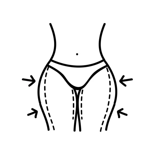 Schönheitsoperationen Stehen Frauen Bevor Fettabsaugung Oberschenkel Körperkonturierung Handgezeichnete Vektorillustration Editierbarer — Stockvektor