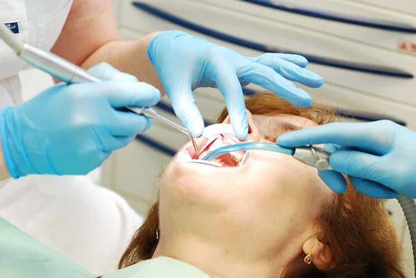 Work of doctors in the dental clinic — Stock Photo, Image