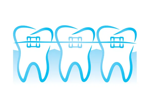 Braces de dents — Image vectorielle